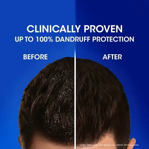 Head & Shoulders Smooth & Silky Anti Dandruff Shampoo
