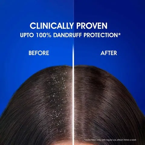 Head & Shoulders Anti Dandruff Shampoo